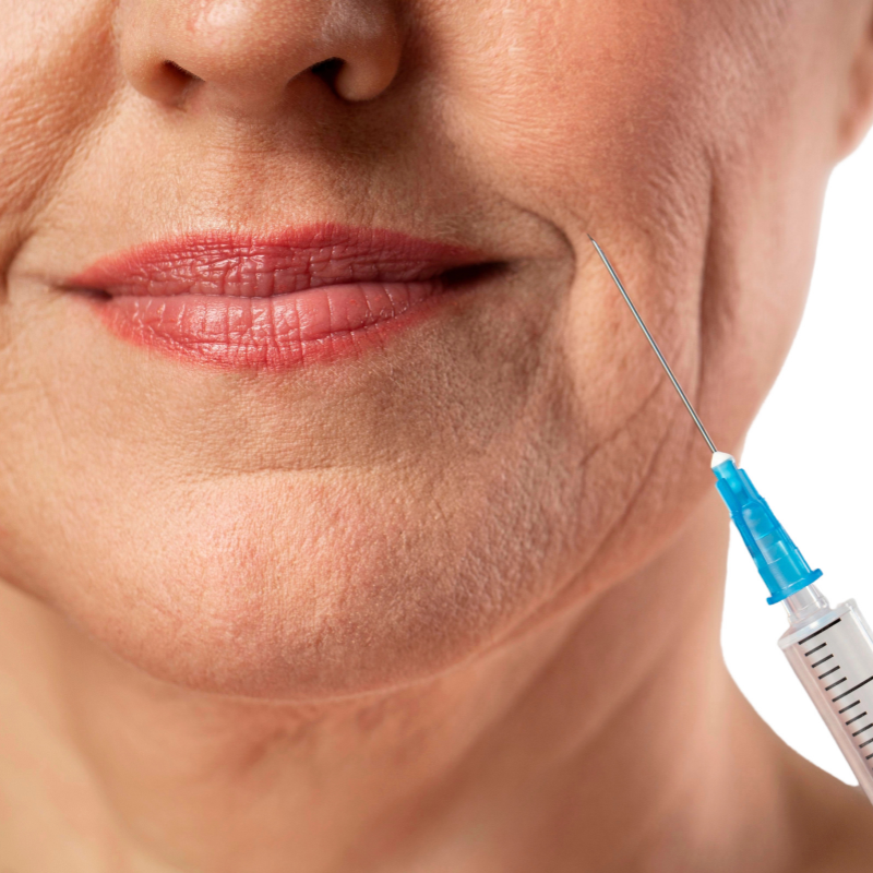 Botox®